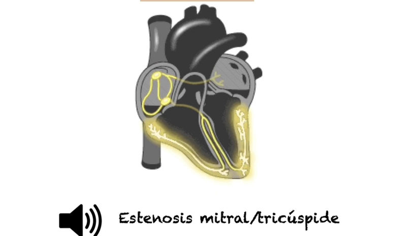 AUSCULTACIONCARDIACA